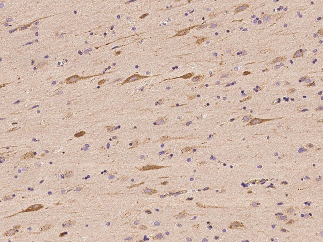 PRKAR1A Antibody in Immunohistochemistry (Paraffin) (IHC (P))