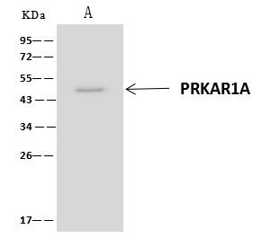 PRKAR1A Antibody in Immunoprecipitation (IP)