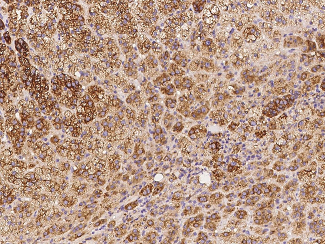 PRKAR2B Antibody in Immunohistochemistry (Paraffin) (IHC (P))