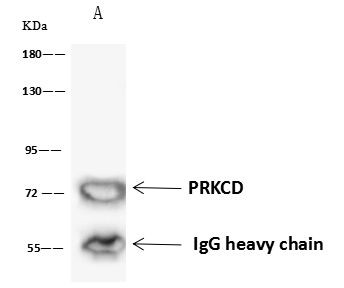 PKC delta Antibody in Immunoprecipitation (IP)