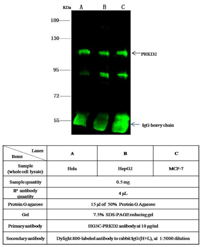 PRKD2 Antibody in Immunoprecipitation (IP)