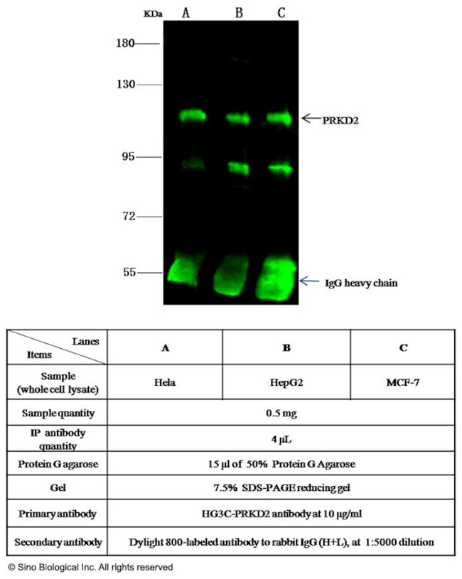 PRKD2 Antibody in Immunoprecipitation (IP)