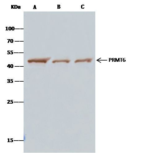 PRMT6 Antibody in Immunoprecipitation (IP)