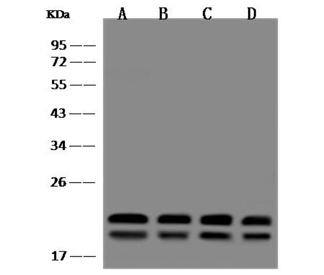 Presenilin 1 Antibody in Western Blot (WB)