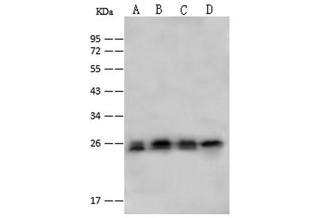 PSMA2 Antibody in Western Blot (WB)