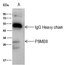 PSMB8 Antibody in Immunoprecipitation (IP)