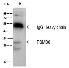 PSMB8 Antibody in Immunoprecipitation (IP)