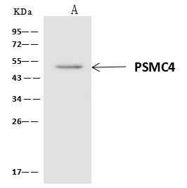 PSMC4 Antibody in Immunoprecipitation (IP)