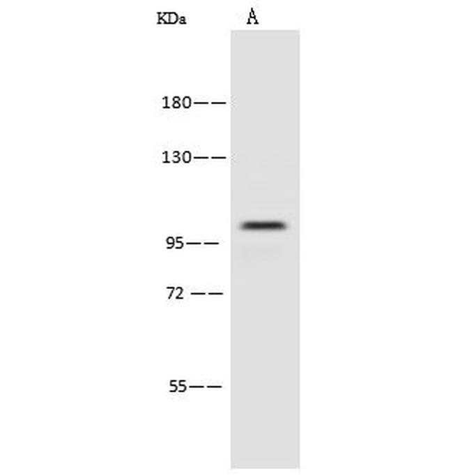 PSMD2 Antibody in Western Blot (WB)