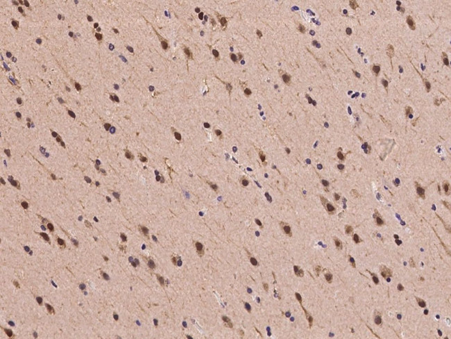 PSMD7 Antibody in Immunohistochemistry (Paraffin) (IHC (P))