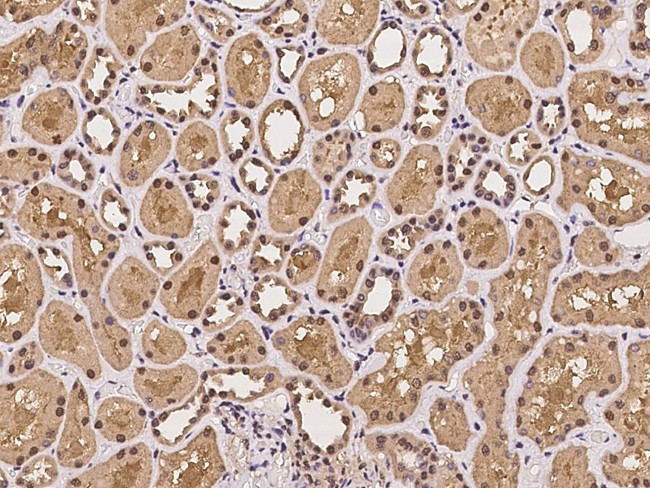 PSMD9 Antibody in Immunohistochemistry (Paraffin) (IHC (P))