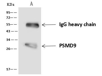 PSMD9 Antibody in Immunoprecipitation (IP)