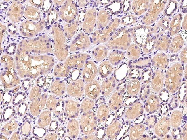 PTPN12 Antibody in Immunohistochemistry (Paraffin) (IHC (P))