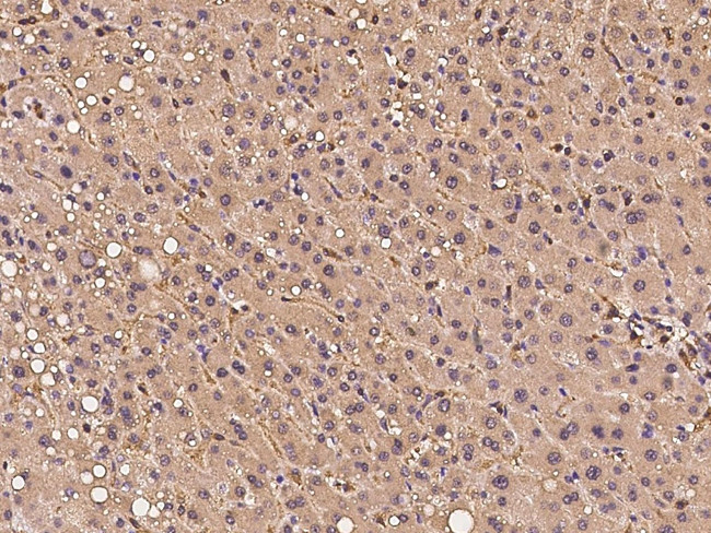 PTPN12 Antibody in Immunohistochemistry (Paraffin) (IHC (P))