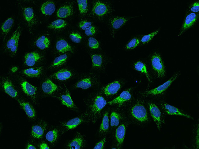 Bit1 Antibody in Immunocytochemistry (ICC/IF)