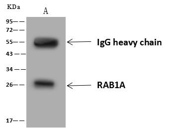 RAB1A Antibody in Immunoprecipitation (IP)