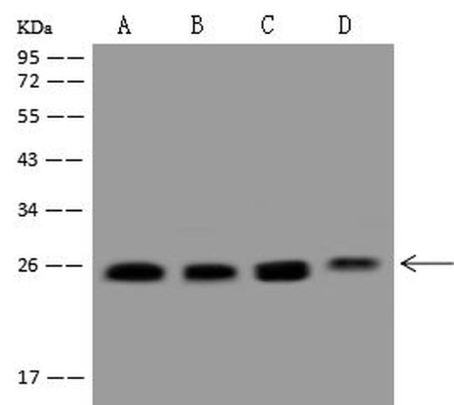 RAB1A Antibody in Western Blot (WB)