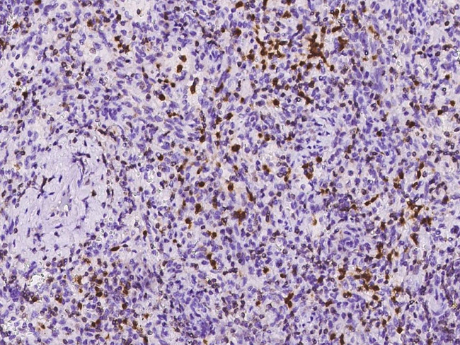 RAB27A Antibody in Immunohistochemistry (Paraffin) (IHC (P))