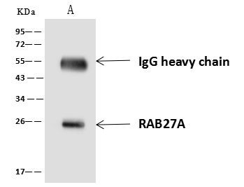 RAB27A Antibody in Immunoprecipitation (IP)