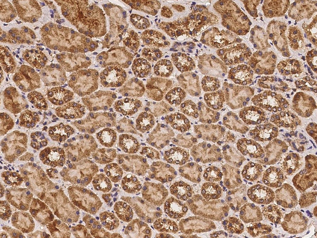 RAB7A Antibody in Immunohistochemistry (Paraffin) (IHC (P))