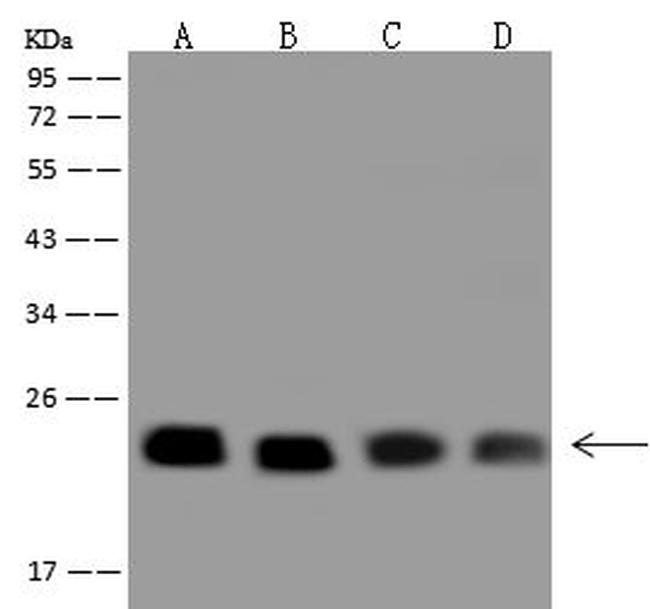 RAB9 Antibody in Western Blot (WB)