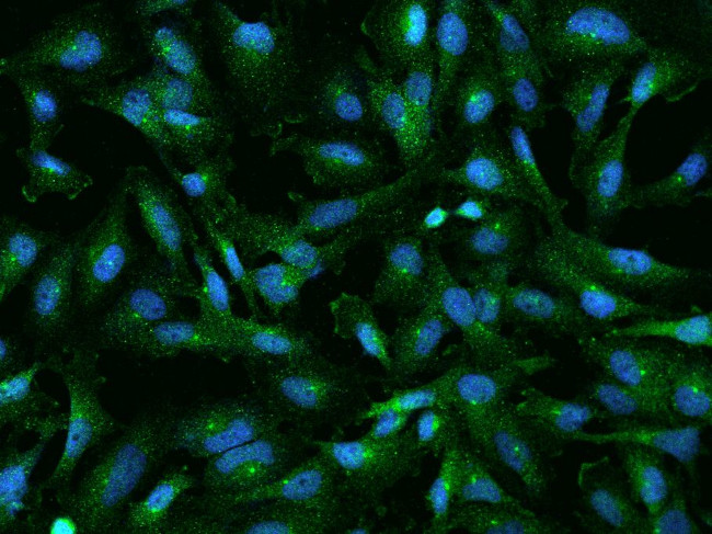 RABEP1 Antibody in Immunocytochemistry (ICC/IF)