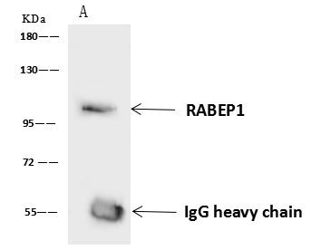 RABEP1 Antibody in Immunoprecipitation (IP)