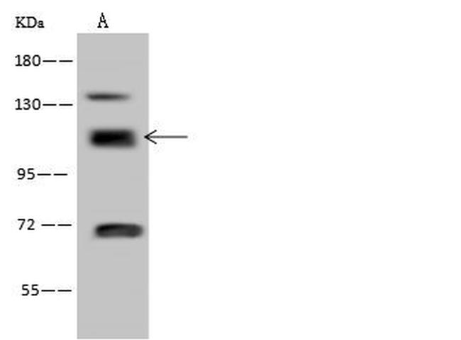 RABEP1 Antibody in Western Blot (WB)