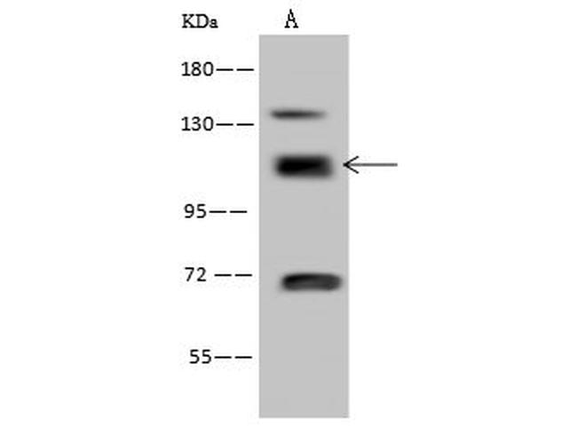 RABEP1 Antibody in Western Blot (WB)
