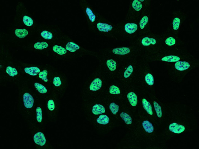 RALY Antibody in Immunocytochemistry (ICC/IF)