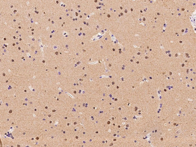 RBM17 Antibody in Immunohistochemistry (Paraffin) (IHC (P))