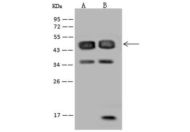 RBM17 Antibody in Western Blot (WB)