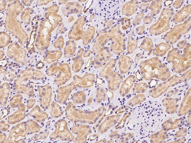 RDH14 Antibody in Immunohistochemistry (Paraffin) (IHC (P))