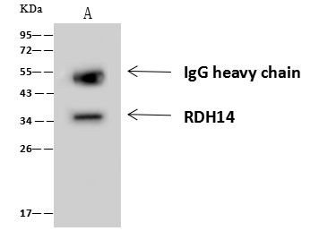 RDH14 Antibody in Immunoprecipitation (IP)