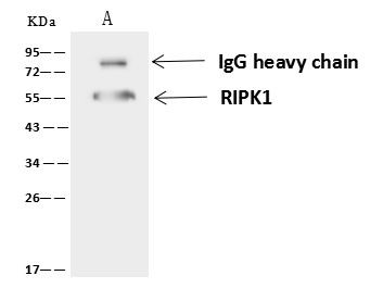 RIP1 Antibody in Immunoprecipitation (IP)