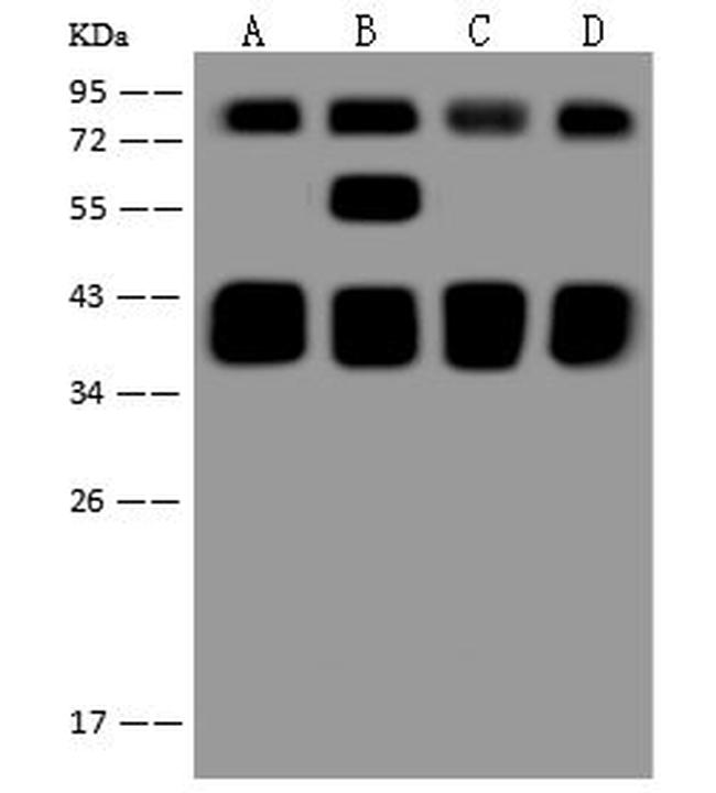 RIP1 Antibody in Western Blot (WB)