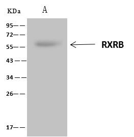 RXRB Antibody in Immunoprecipitation (IP)