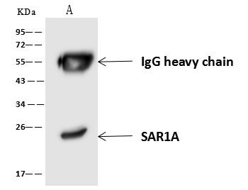 SAR1A Antibody in Immunoprecipitation (IP)