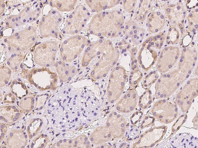 ACN9 Antibody in Immunohistochemistry (Paraffin) (IHC (P))