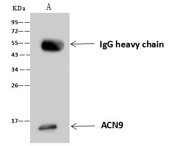 ACN9 Antibody in Immunoprecipitation (IP)