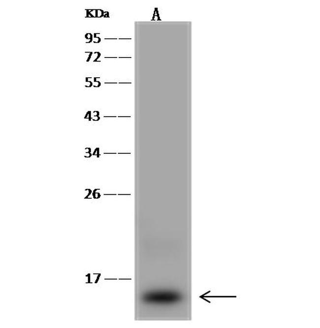 ACN9 Antibody in Western Blot (WB)