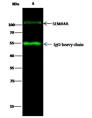 SEMA4A Antibody in Immunoprecipitation (IP)