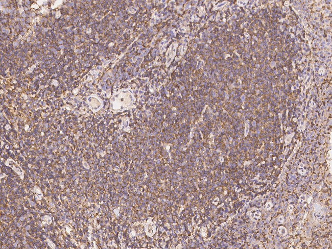 Ly-108 Antibody in Immunohistochemistry (Paraffin) (IHC (P))