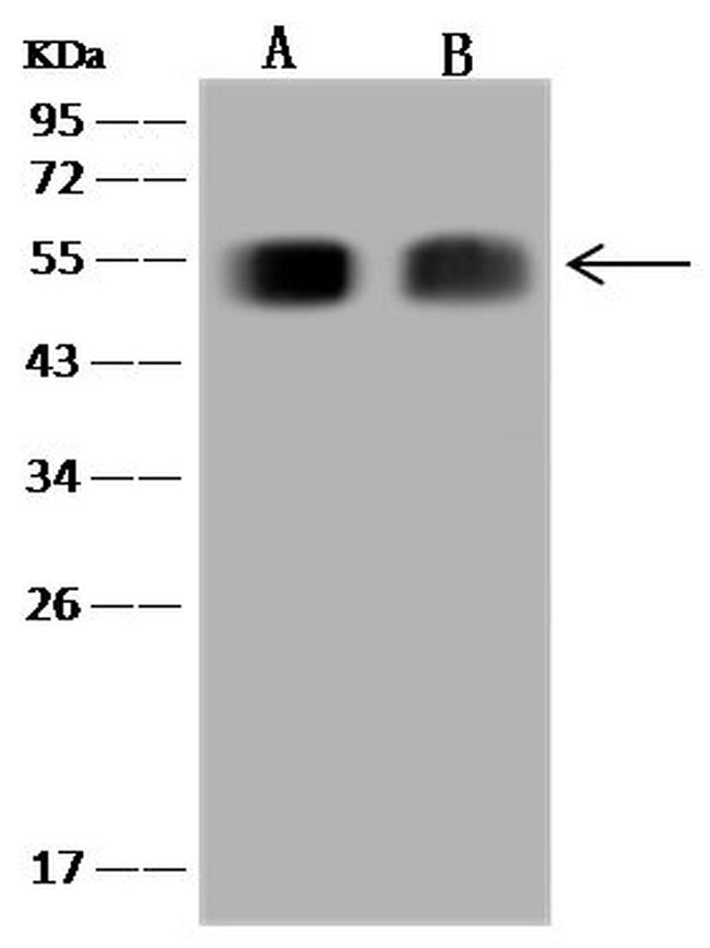 EBP50 Antibody in Western Blot (WB)