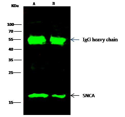 alpha Synuclein Antibody in Immunoprecipitation (IP)