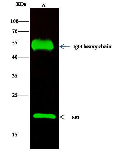 Sorcin Antibody in Immunoprecipitation (IP)