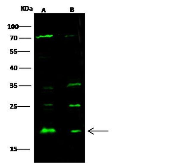 Sorcin Antibody in Western Blot (WB)