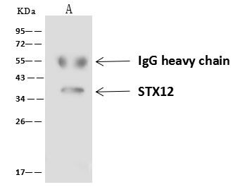 STX12 Antibody in Immunoprecipitation (IP)