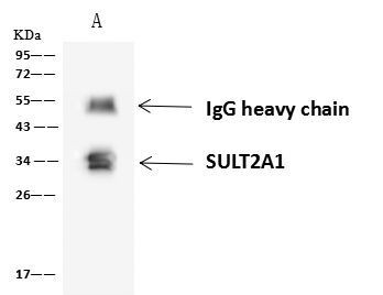 SULT2A1 Antibody in Immunoprecipitation (IP)