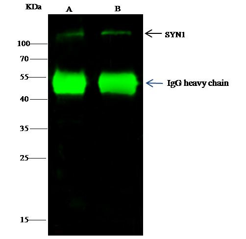 Synapsin 1 Antibody in Immunoprecipitation (IP)